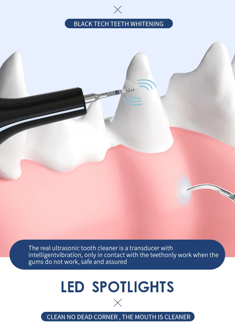 Pet Oral Care Dental Beauty Device Electric Dental Flusher for Dogs Portable Dental Stone Removal Ultrasonic Cleaner