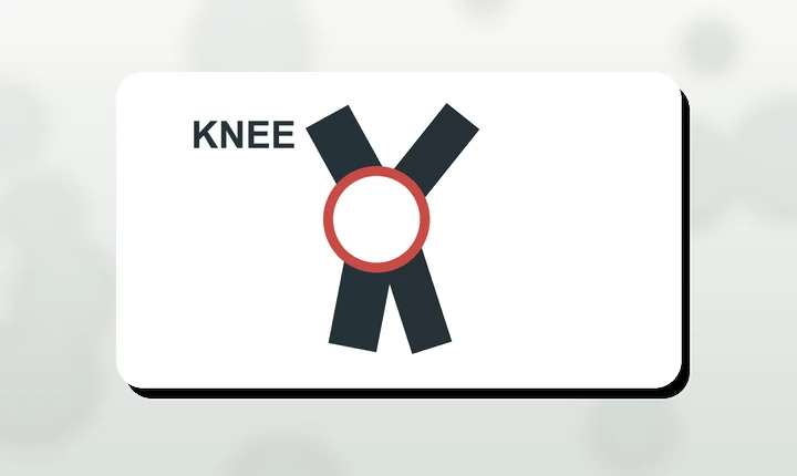 Illustration of a runner with the knee highlighted